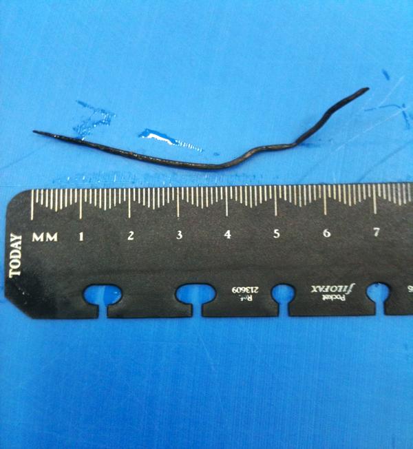 Treating hardware disease in cows 18 January 2015 Free